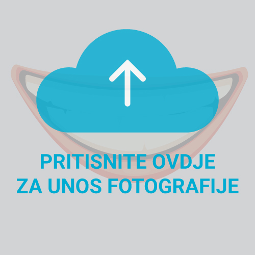 prednja_strana_zubi